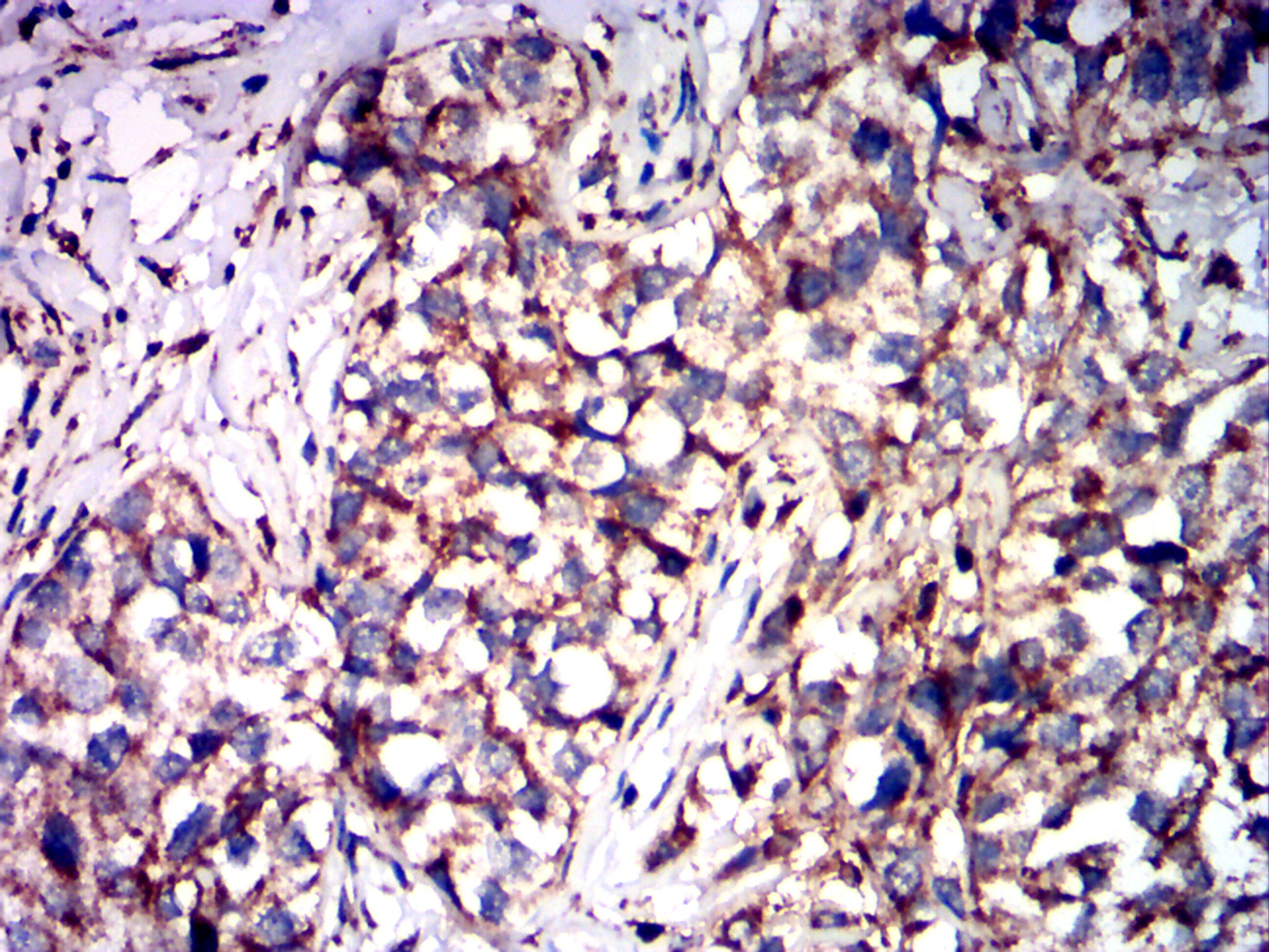 Mouse Monoclonal Antibody to CD1A