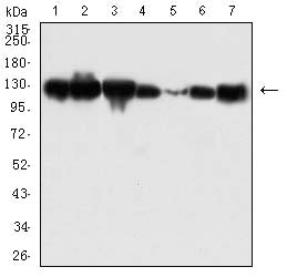 CDH1