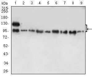 CDH1