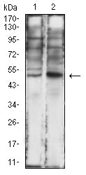 CD121B
