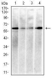 HDAC1