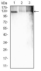 ATP1A1
