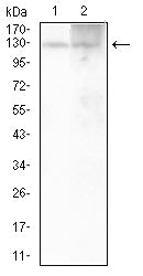 ATP1A1