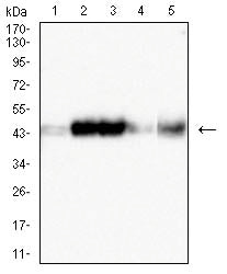 CD319