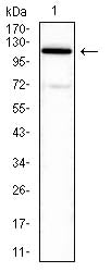 ATP6AP1