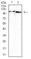 ATP6AP1