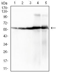 ATP5F1A