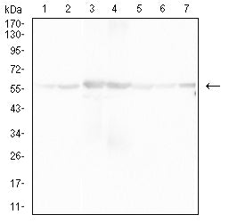 ATP5F1A