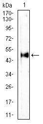 HLA-C