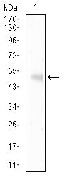 HLA-F