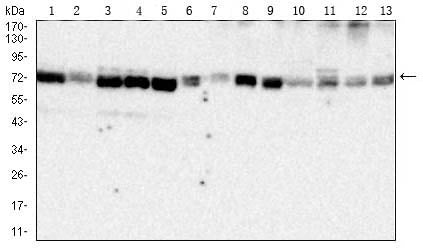 HSPA9