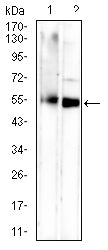 TNFRSF11A