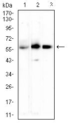 TNFRSF11A