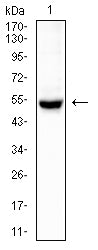 KRT14