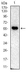 SLC22A12