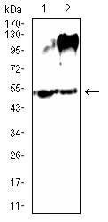 SLC7A3