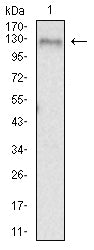 CD156B