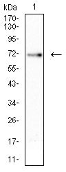 HNF1B