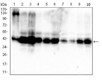 PDHA1