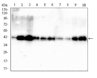 PDHA1