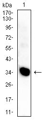 HLA-DPA1