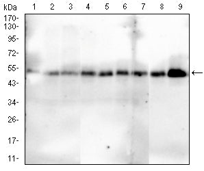 SMAD1
