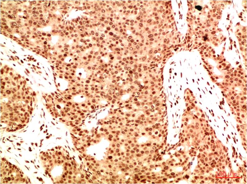 Acetyl-NF-KB p65 (Lys314/Lys315)