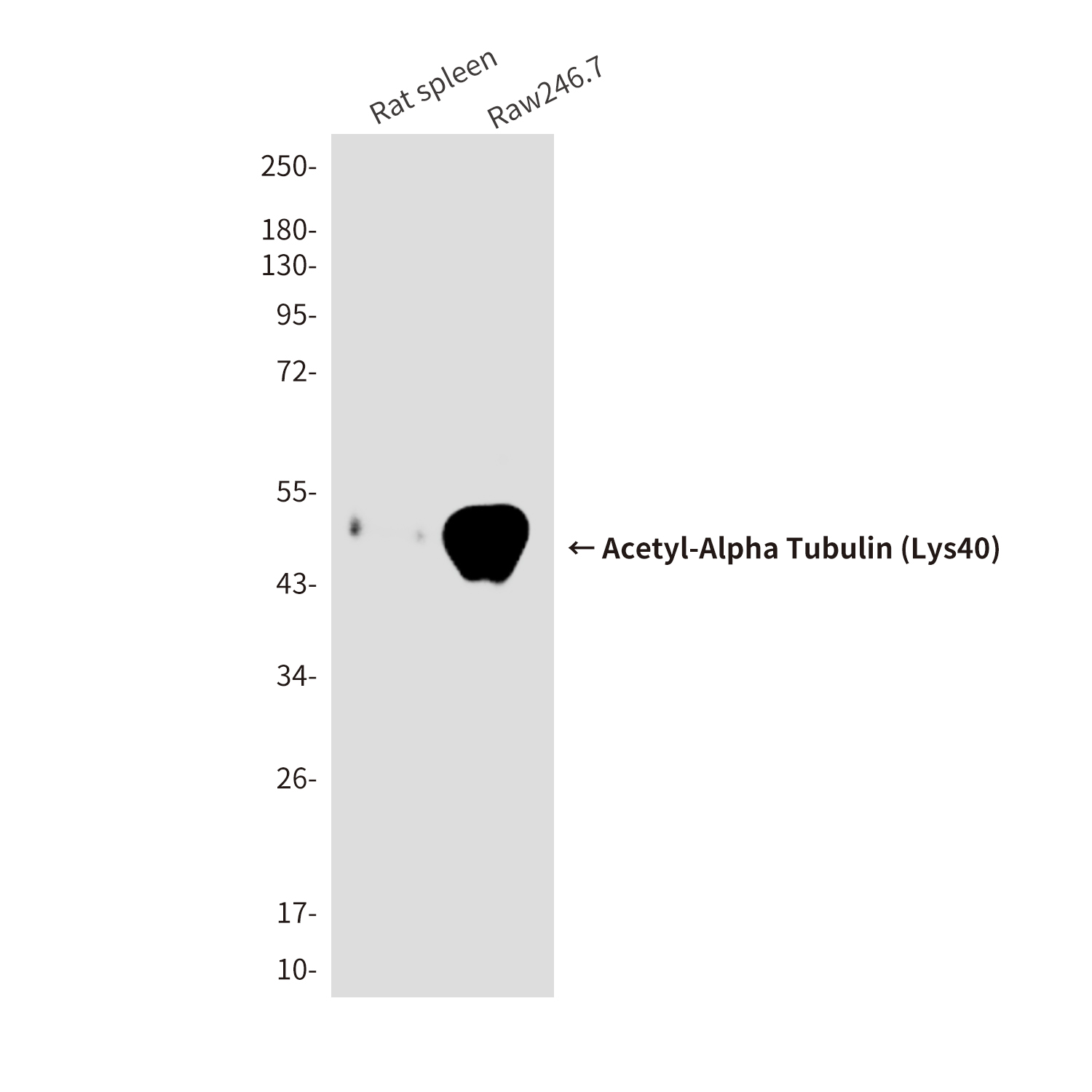 Acetyl-Alpha Tubulin (Lys40)