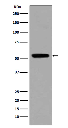 Acetyl-p53 (Lys370)