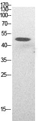 Acetyl-p53 (Lys382)