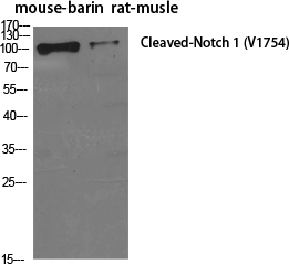 Cleaved-Notch1