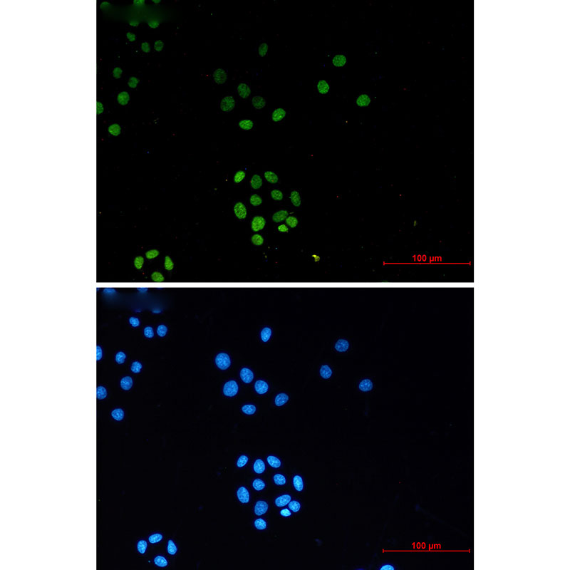 Rabbit Monoclonal Antibody to TriMethyl-Histone H3 (Lys27)