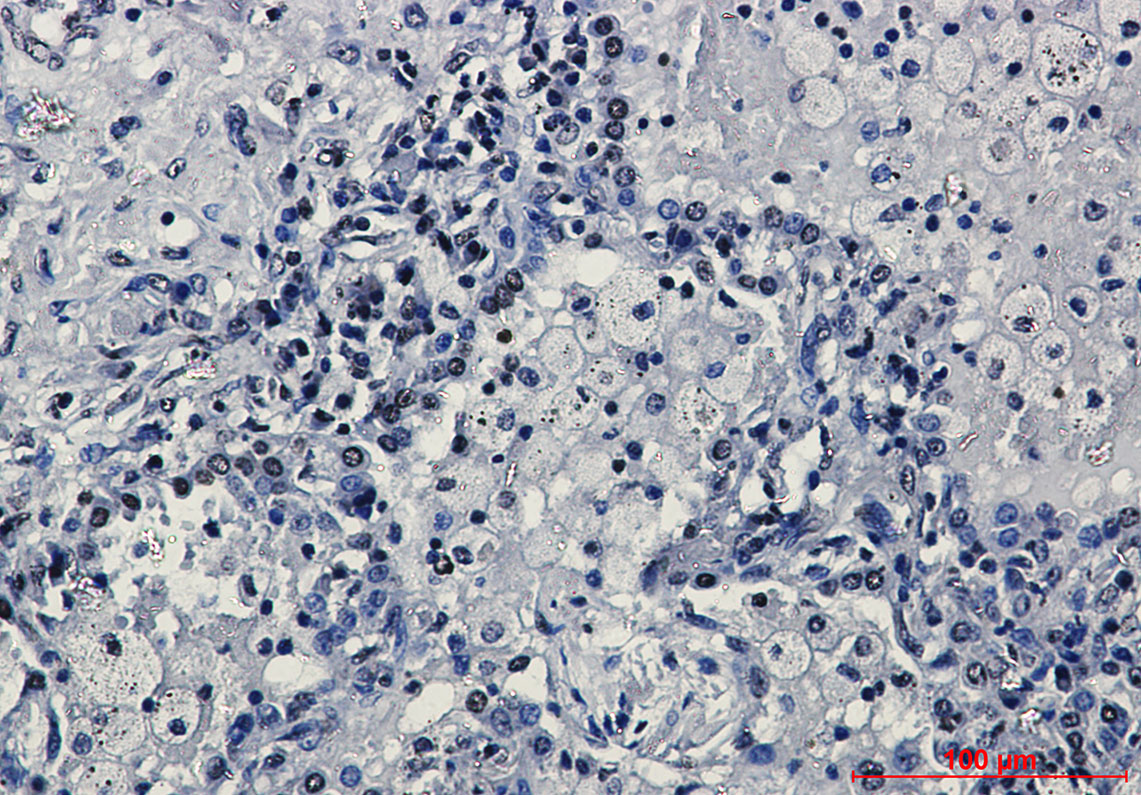 Rabbit Monoclonal Antibody to TriMethyl-Histone H3 (Lys27)