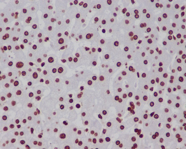 Rabbit Monoclonal Antibody to MonoMethyl-Histone H3 (Lys18) 