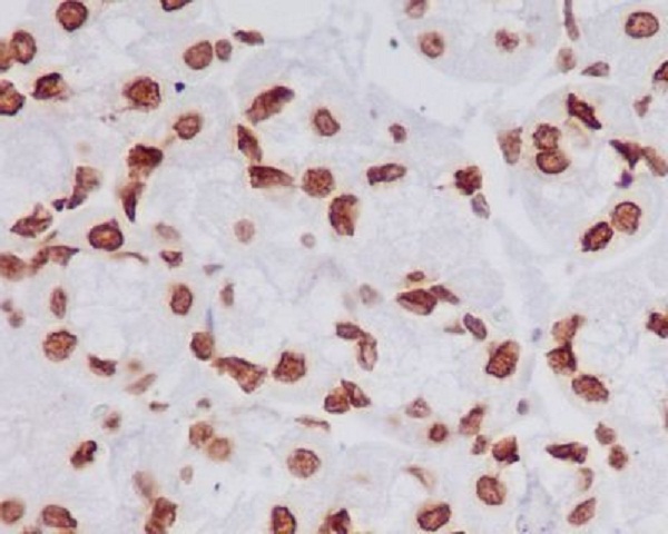 Rabbit Monoclonal Antibody to TriMethyl-Histone H4 (Lys20) 