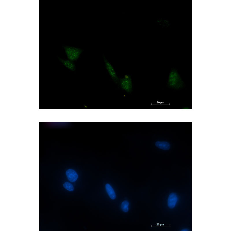 Rabbit Monoclonal Antibody to Phospho-RSK4 (Ser232)
