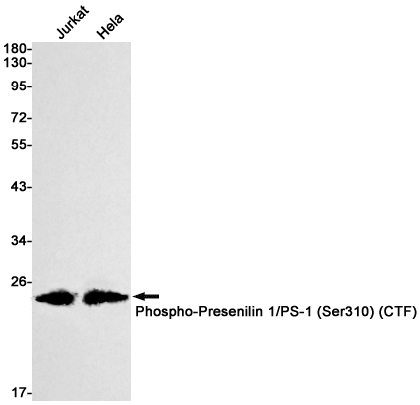 Phospho-Presenilin 1 (Ser310)