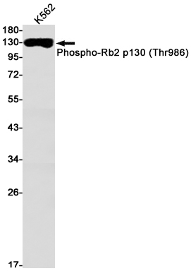 Phospho-Rb2 p130 (Thr986)