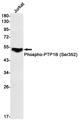 Phospho-PTP1B (Ser352)