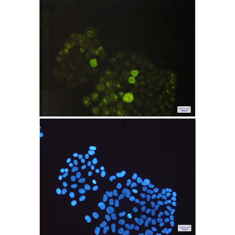 Rabbit Monoclonal Antibody to Phospho-PTP1B (Ser352)