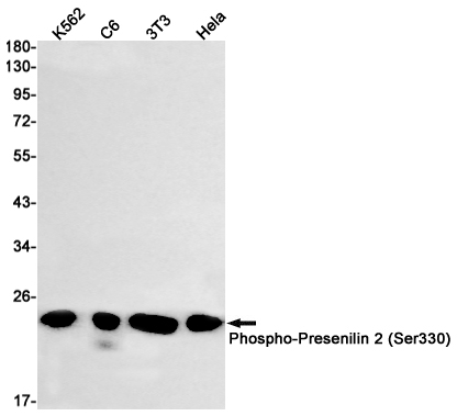 Phospho-Presenilin 2 (Ser330)