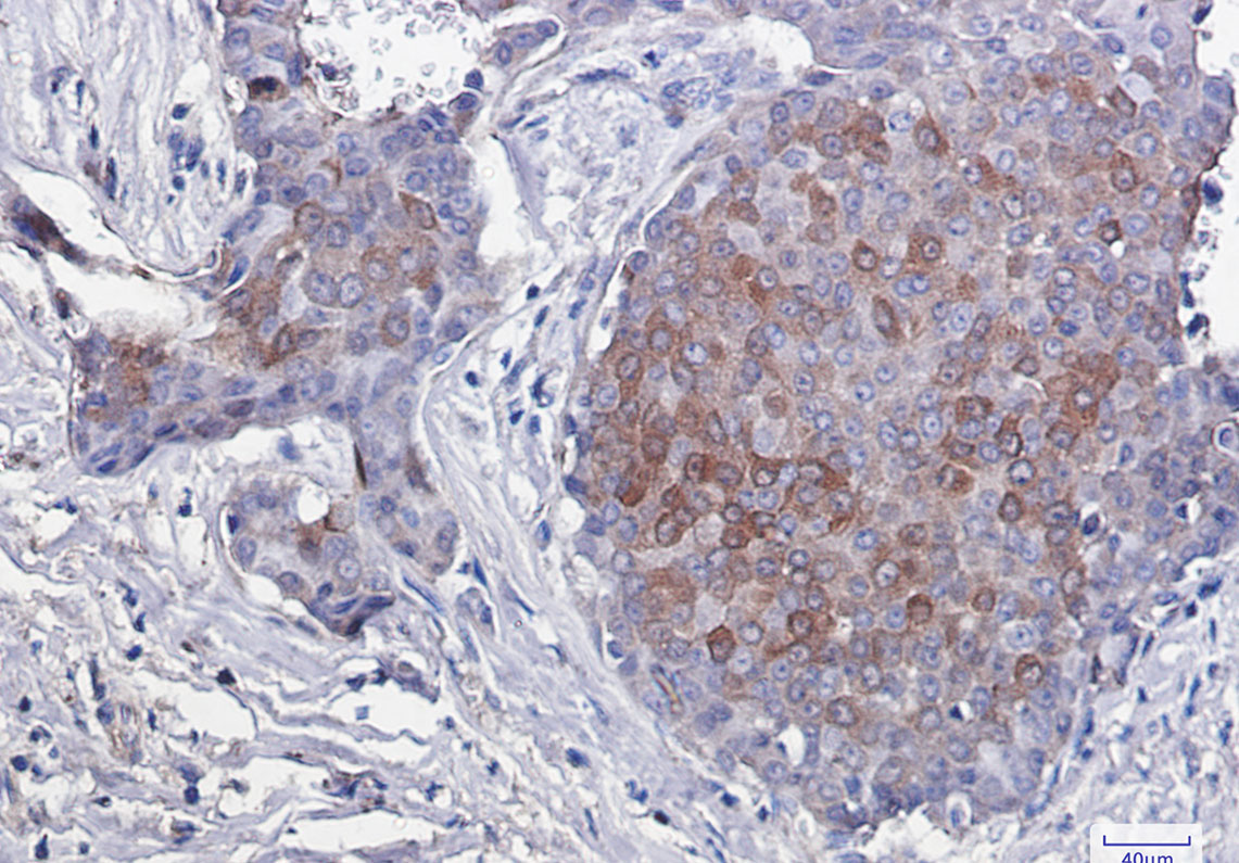 Rabbit Monoclonal Antibody to Phospho-4E BP1 (Thr46)