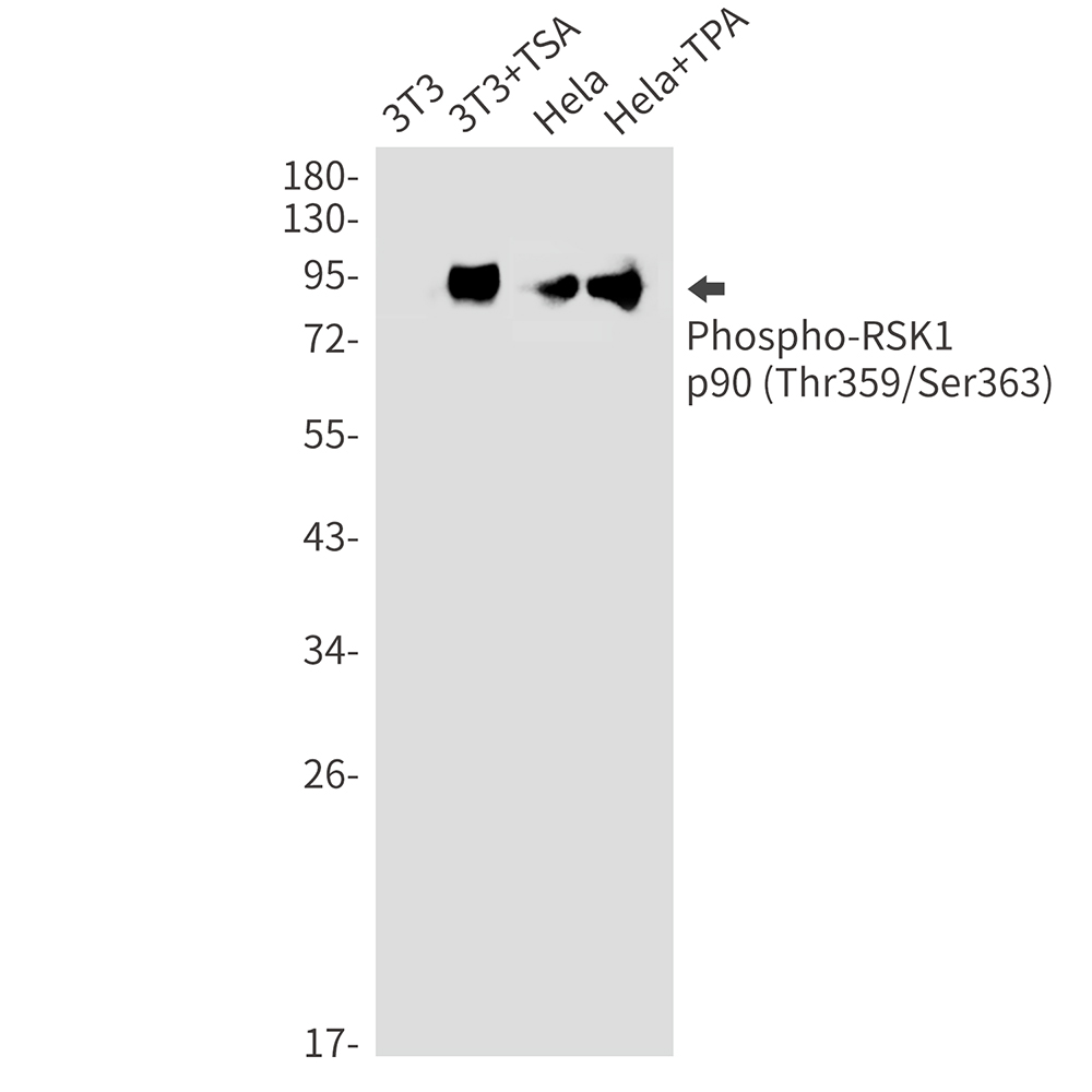 Phospho-RSK1 p90 (Thr359/Ser363)