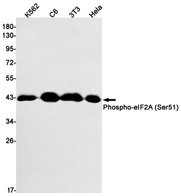 Phospho-eIF2A (Ser51)