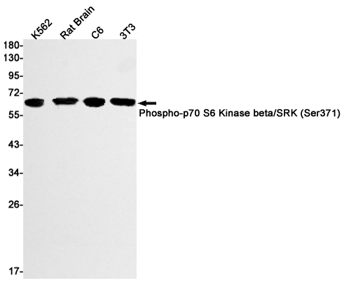 Phospho-S6K2 (Ser371)