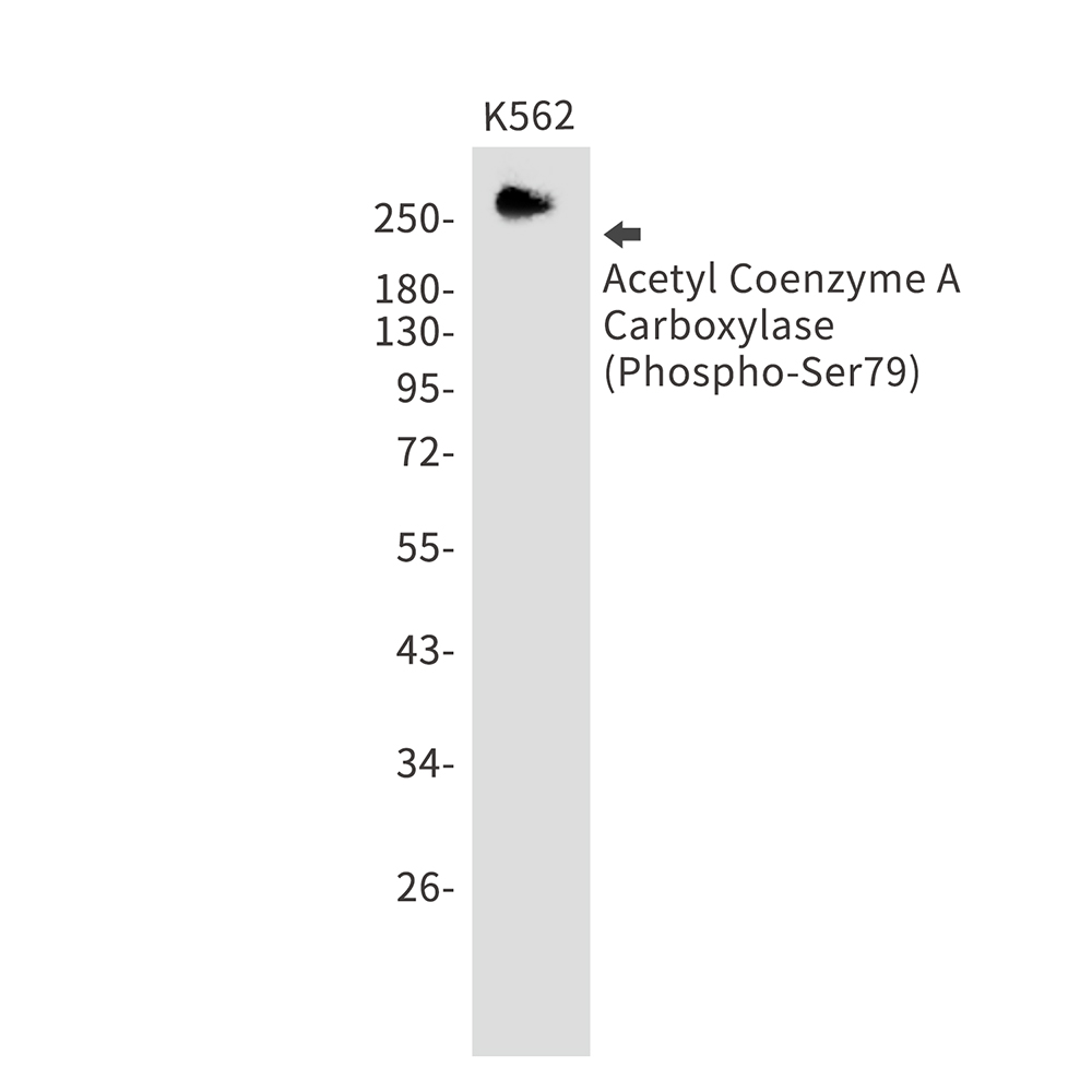 Phospho-Acetyl Coenzyme A Carboxylase (Ser79)
