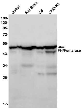 Rabbit Monoclonal Antibody to FH