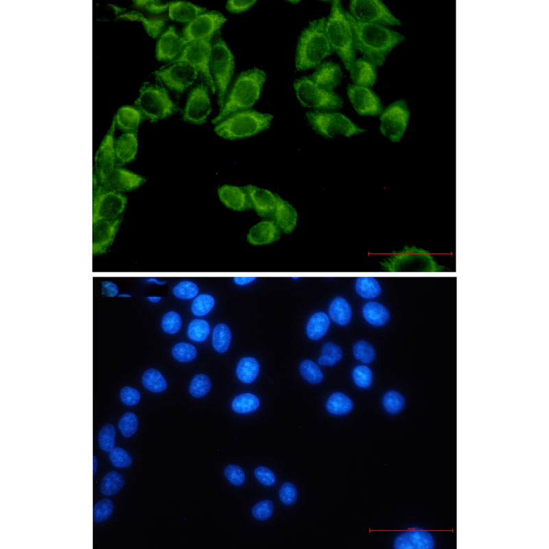 Rabbit Monoclonal Antibody to FH