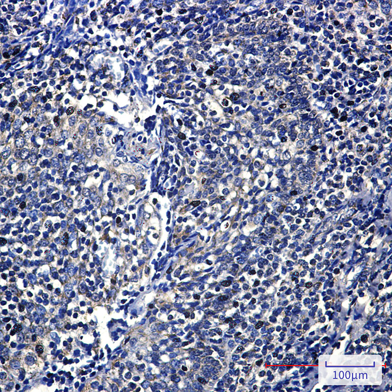 Rabbit Monoclonal Antibody to FH