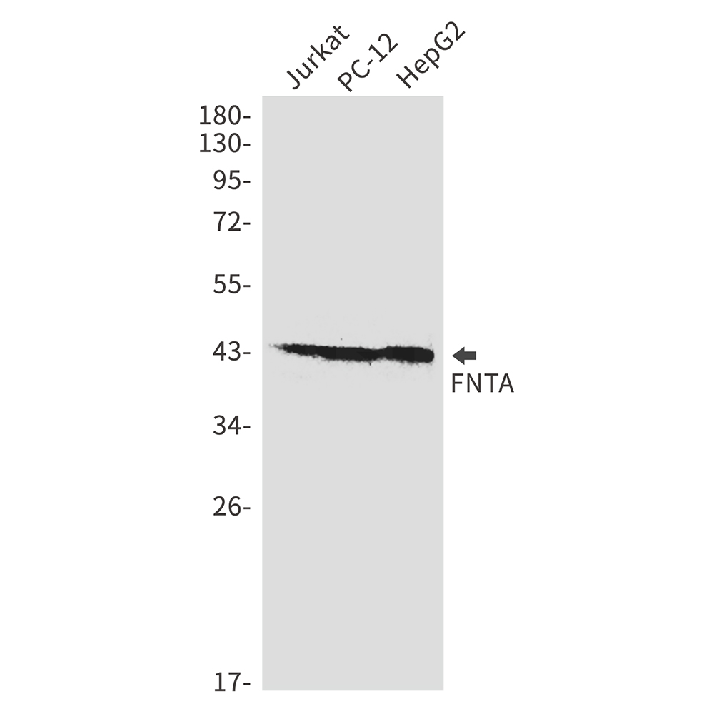 FNTA